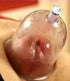 The Empress Pussy Pump Starter Kit Vagina Labia Suction Cup Vacuum Cylinder