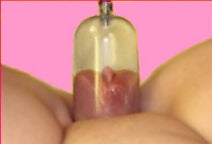 The Empress Pussy Pump Starter Kit Vagina Labia Suction Cup Vacuum Cylinder